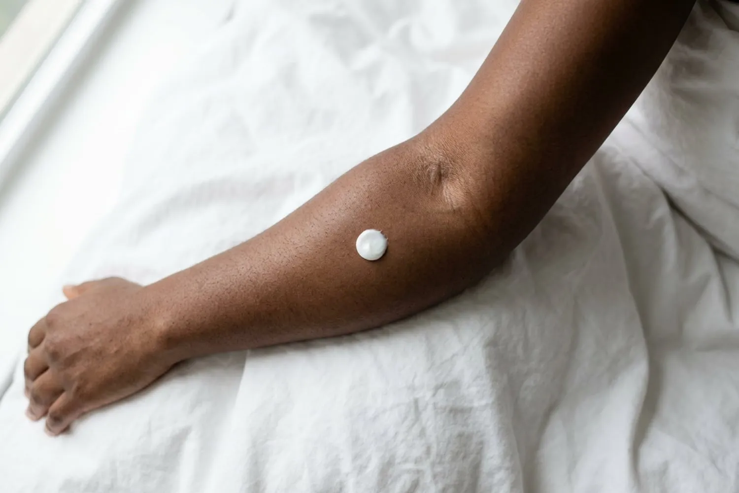 An inner arm turned up on white cotton, seen from above, with a small round dab of white cream about an inch across just below the bend of the elbow; deep brown skin in soft window light