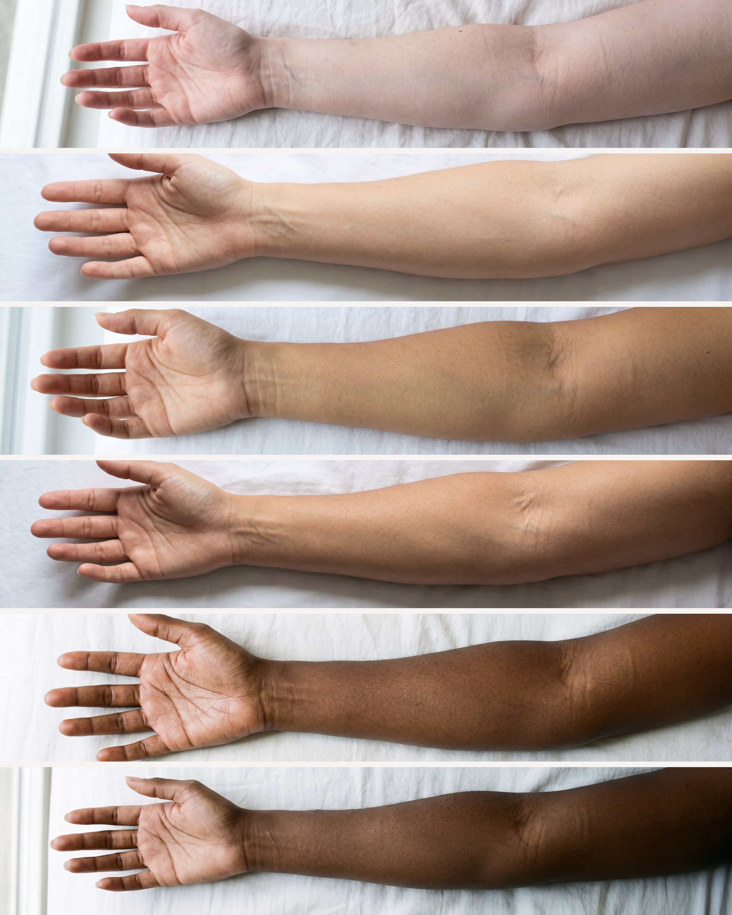 Six bare inner arms laid one above another on a white sheet, palms up, from very fair skin at the top to very deep skin at the bottom.
